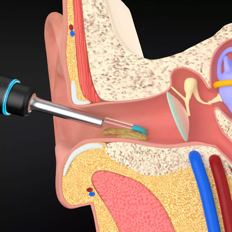 Multifunctional ear spoon set