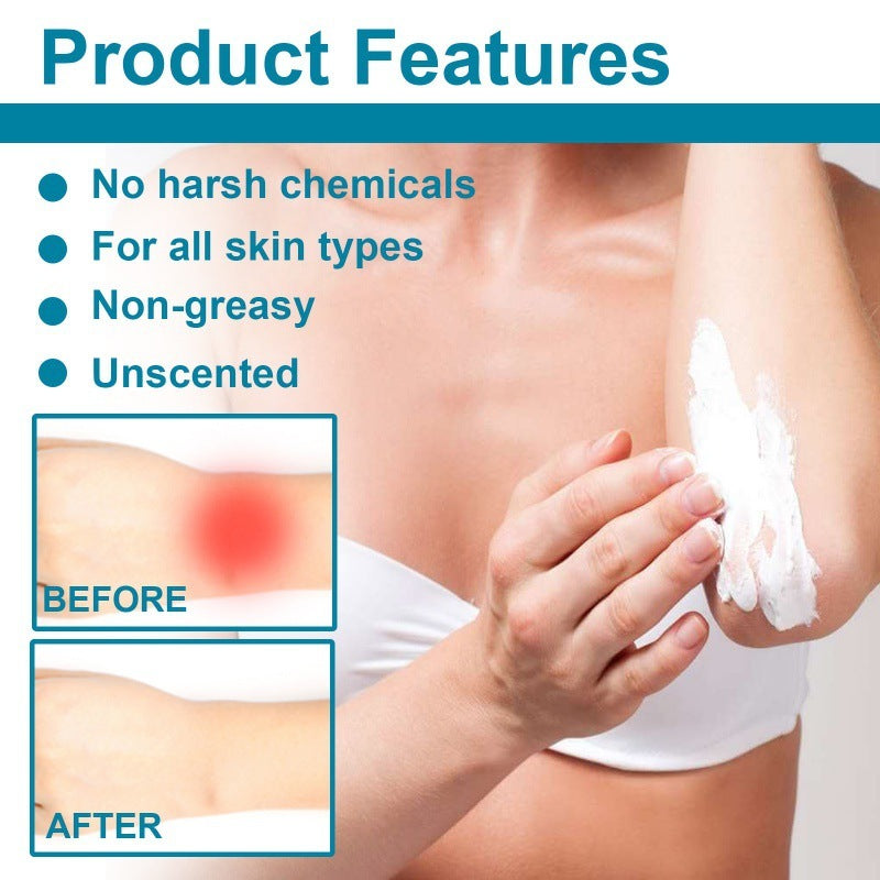 EELHOE Tattoo Repairing Cream Relief Tattoo