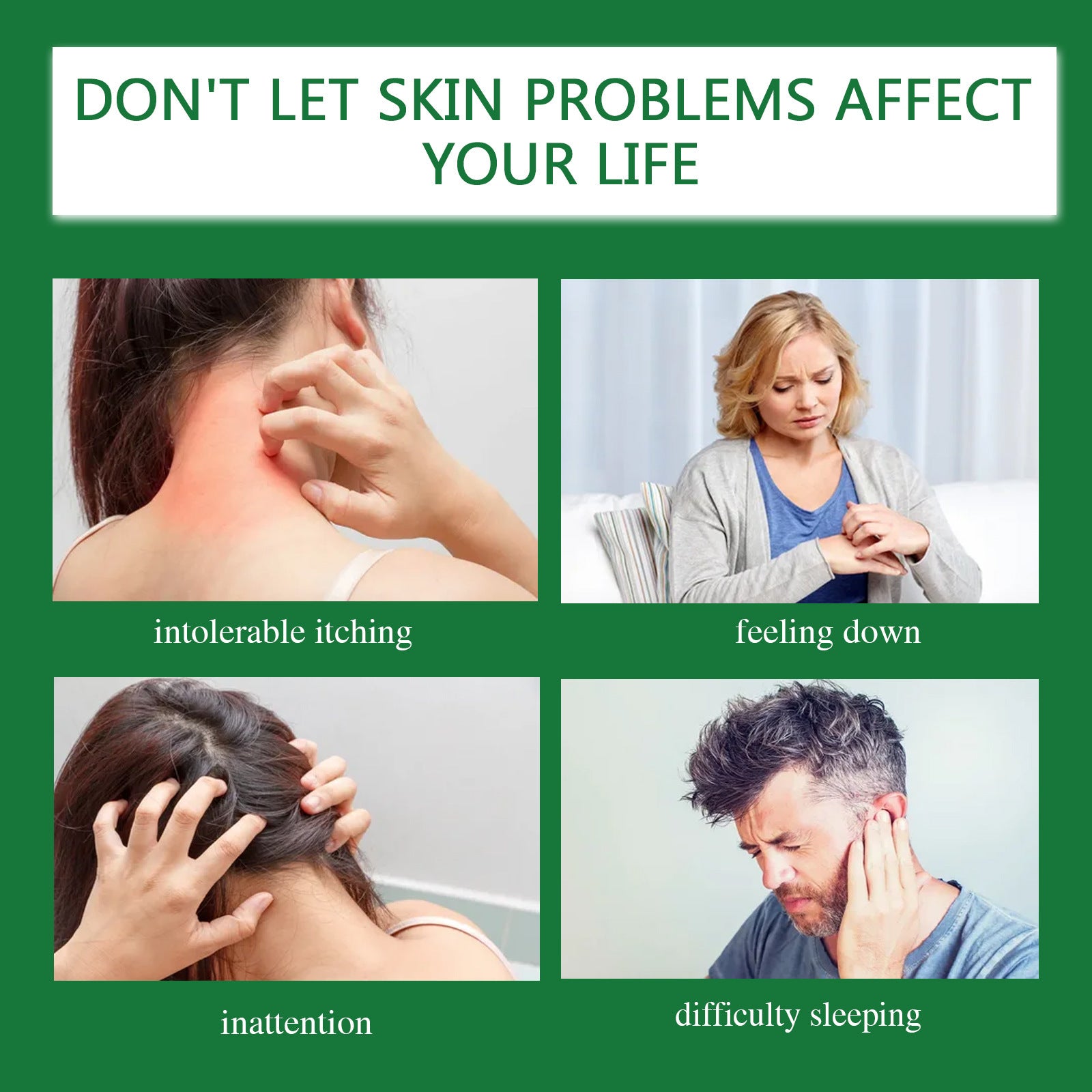 Kraft Moss Cream Relieves Redness And Itching Of Hands And Feet