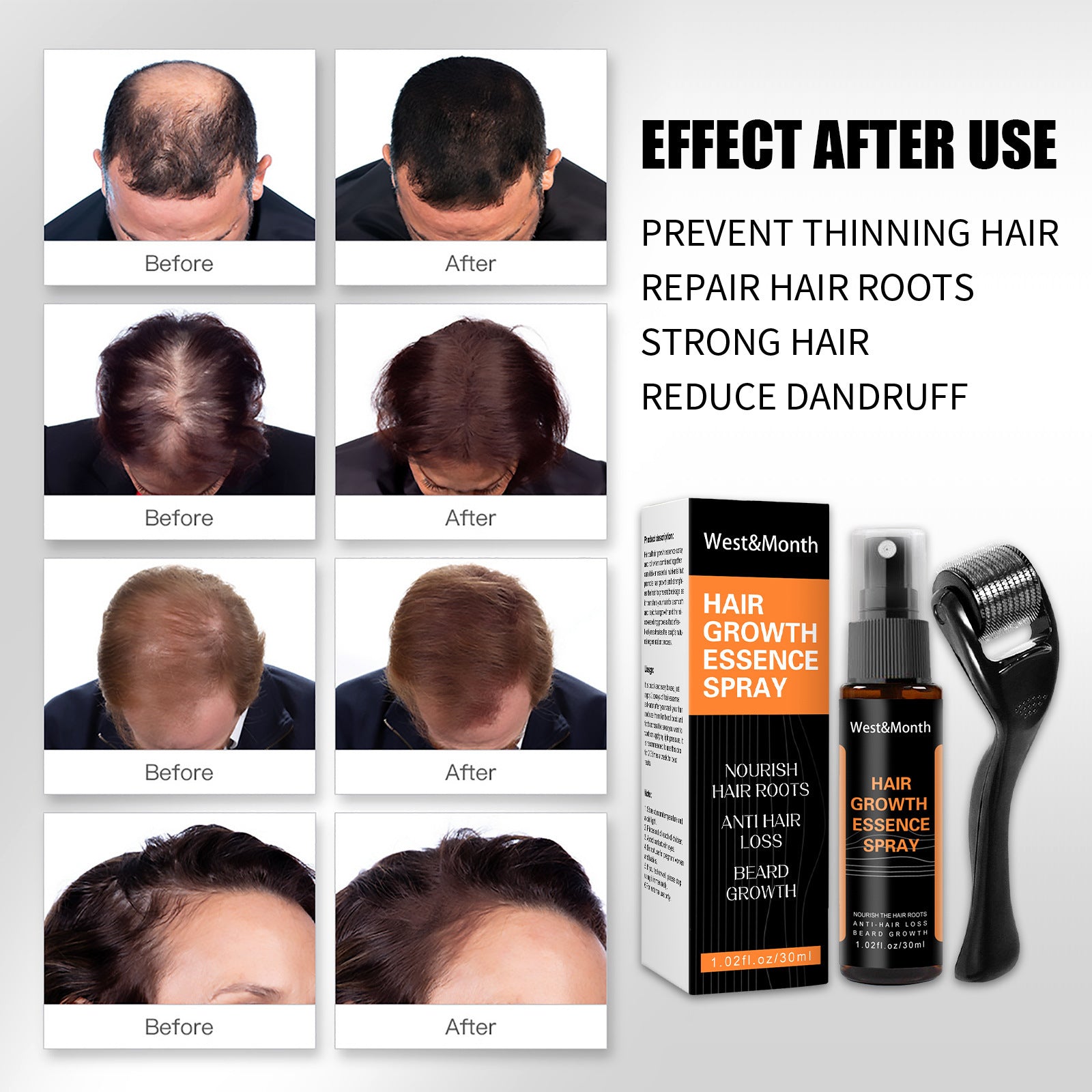 Hair Growth Spray Anti-hair Nourishing Growth Liquid