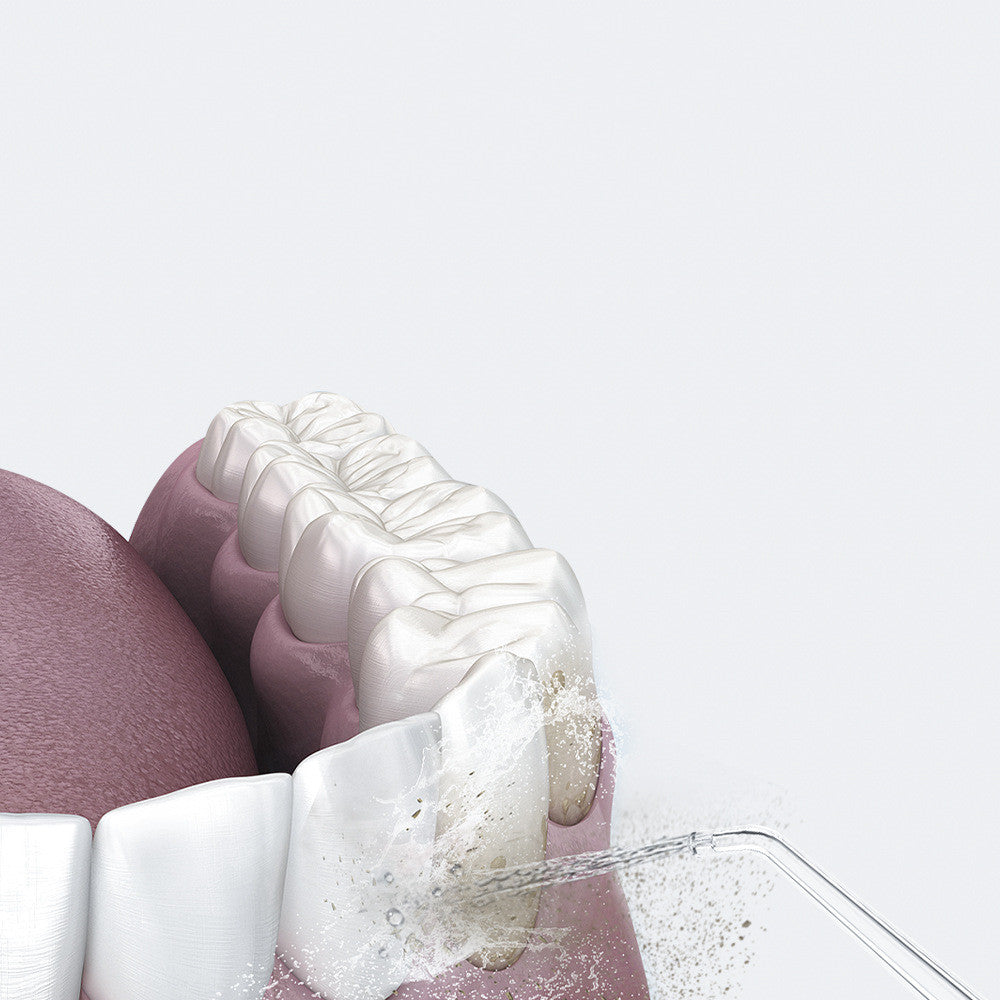 Household Intelligent High Frequency Pulse Electric Tooth Scaler Portable