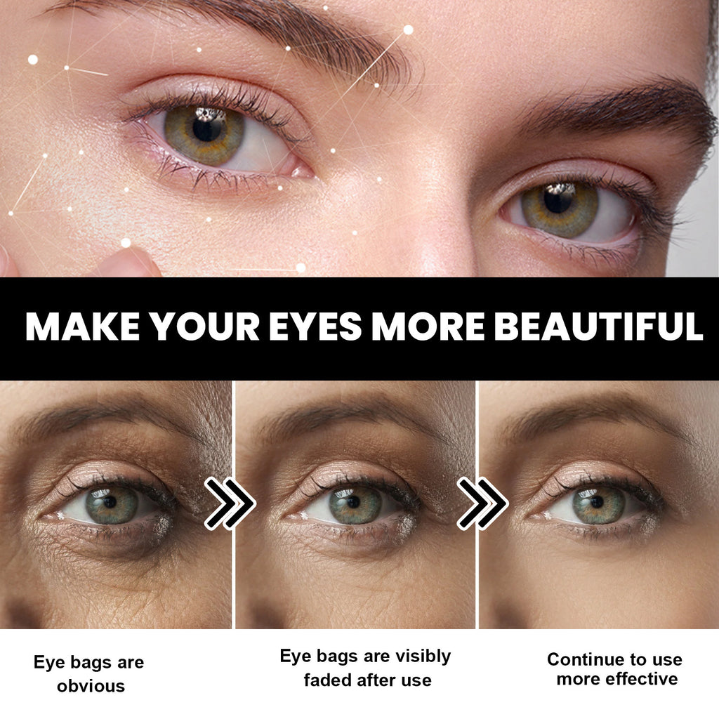 Eye Tightening Cream Fade Wrinkles Eye Bags Dark Circles