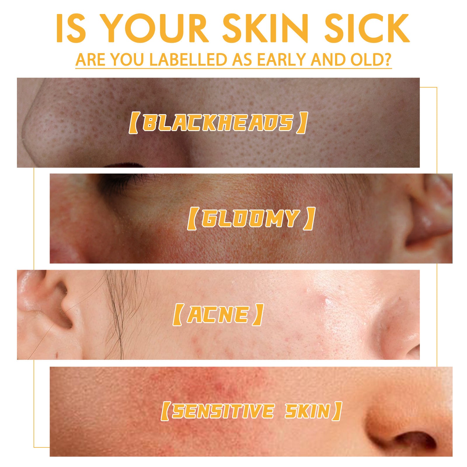 Honey Tearing Mask Nourishing Moisturizing Acne Skin Blackhead Removal Fading Wrinkle Firming